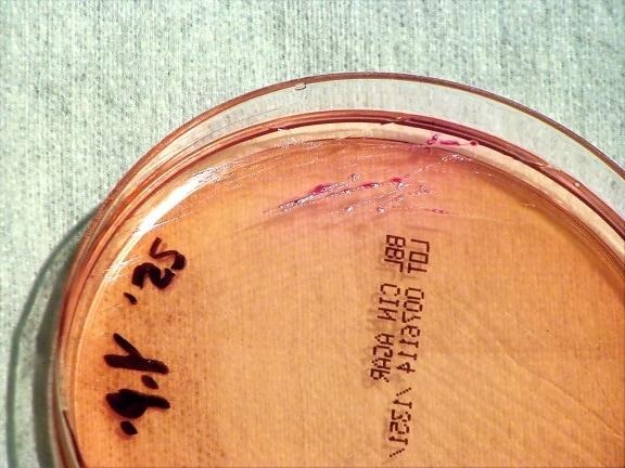 A laboratory culture plate of Yersinia pestis, the bacterium that causes plague, central to the Siberian laboratory death investigation