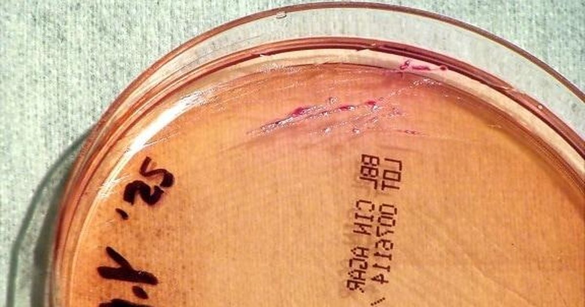 Une chercheuse meurt dans un laboratoire de la peste en Sibérie, Moscou verrouille le récit, Trump veut appeler Poutine